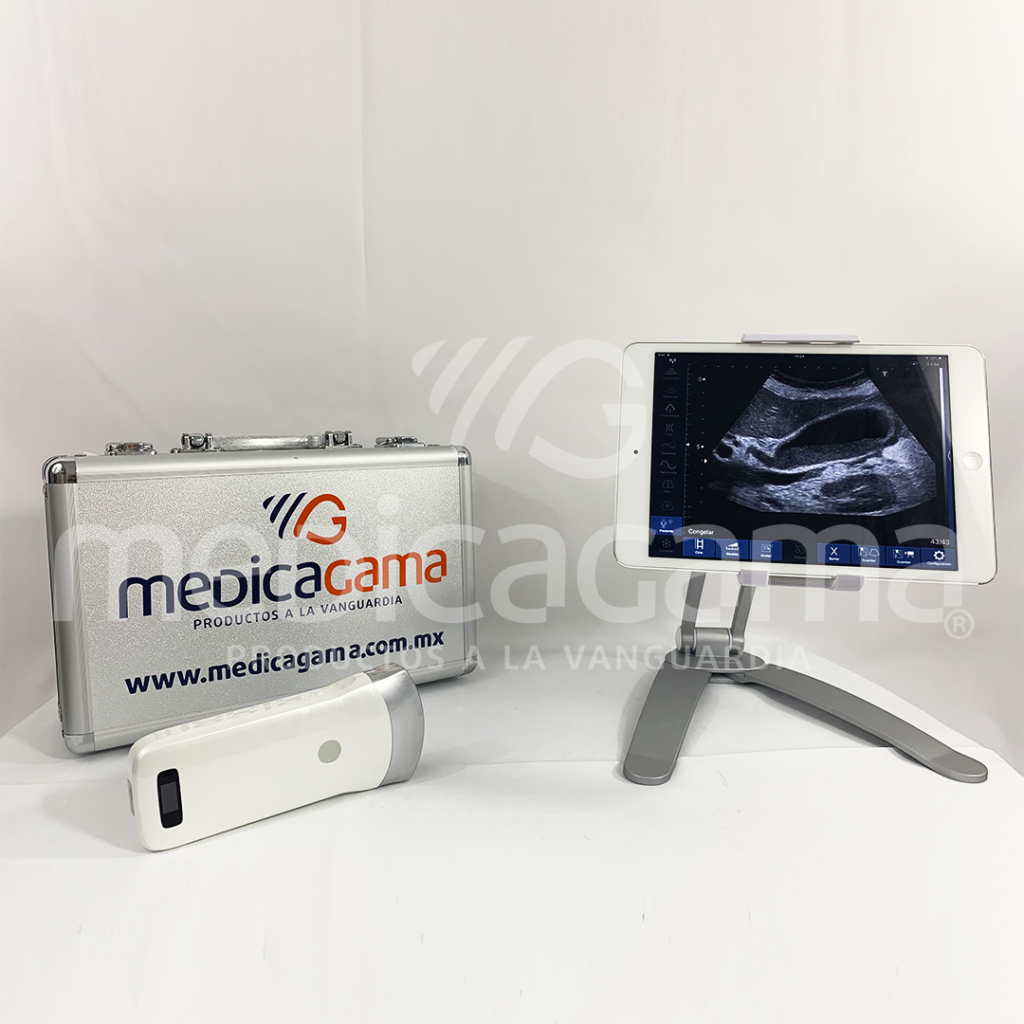 Ultrasonido Wireless Convexo Escala De Grises - MedicaGama